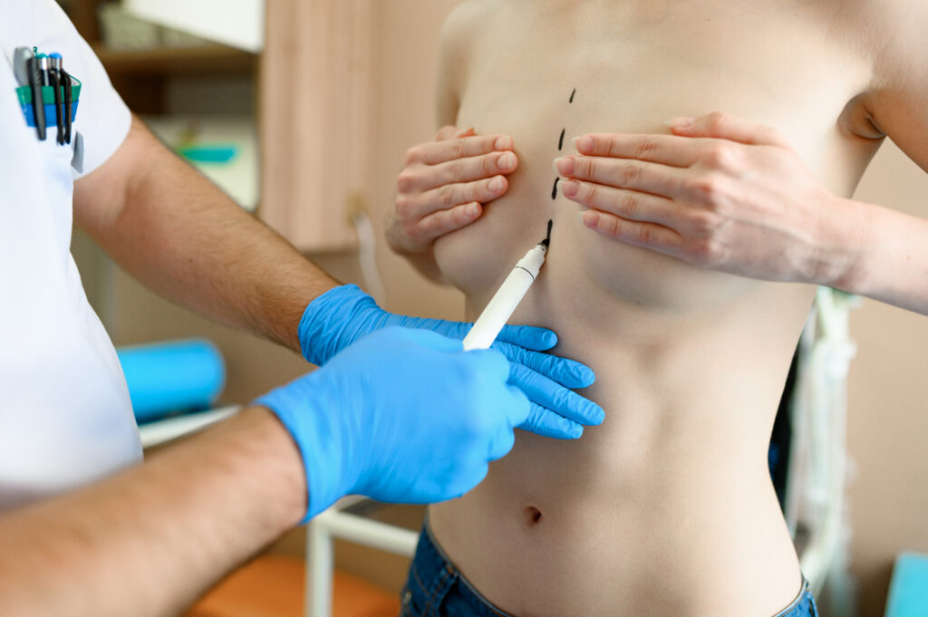 Patient prepares for breast lift in New York City)
