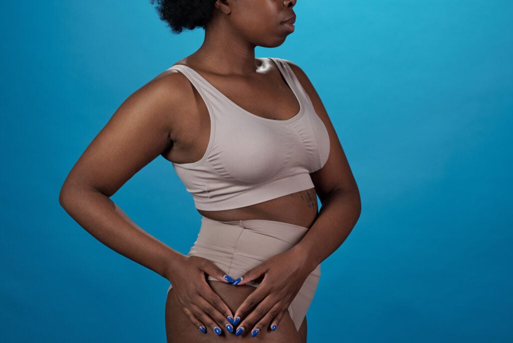 Patient after body contouring Long Island NYC
