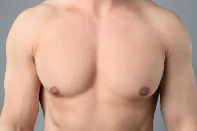 Gynecomastia surgery Long Island NYC)