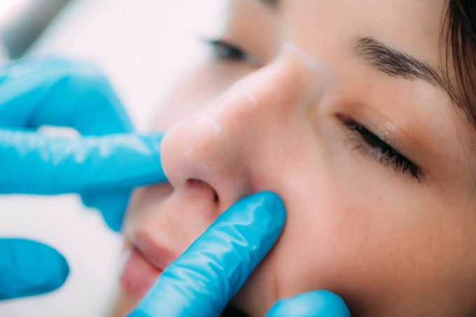 Rhinoplasty surgery Long Island NYC