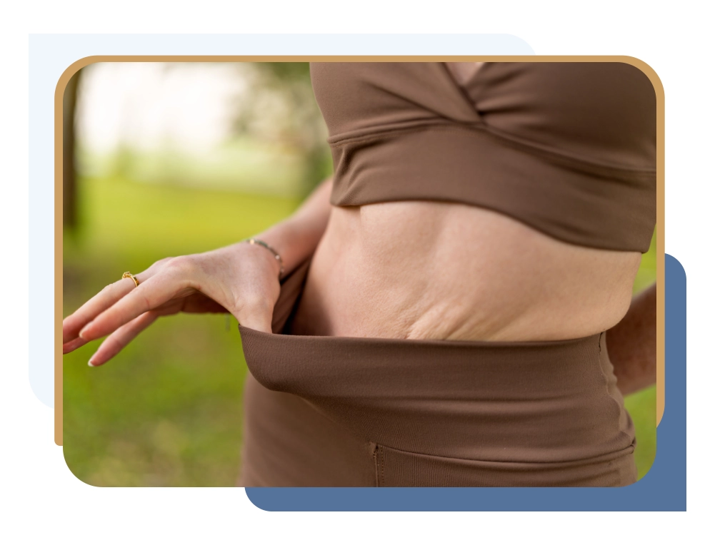 Woman in athletic wear with loose abdominal skin after weight loss