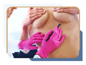 Surgeon establishing whether anchor vs lollipop vs donut breast reduction is best for their patient